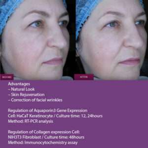 Prostrolane Natural B