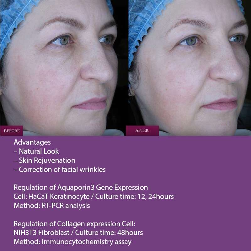 Prostrolane Natural B