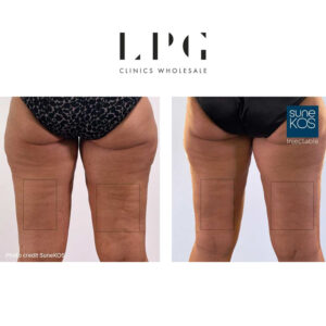 Sunekos ® Body Sunekos ® Body