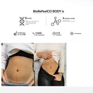 BioRePeelCl3 BODY