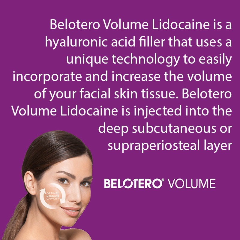Belotero® Volume with Lidocaine
