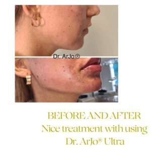 Dr Arjo Ultra Dr Arjo Ultra