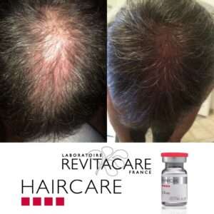 Haircare Before and After 4