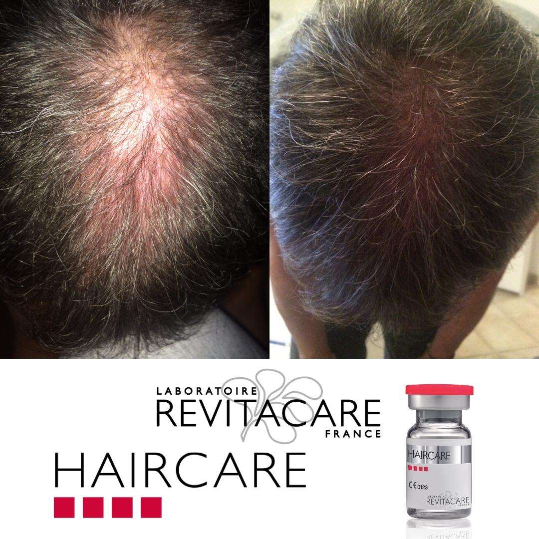 Haircare Before and After 4