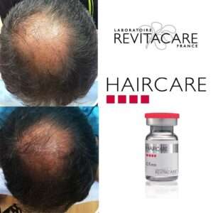 Haircare Before and After 5